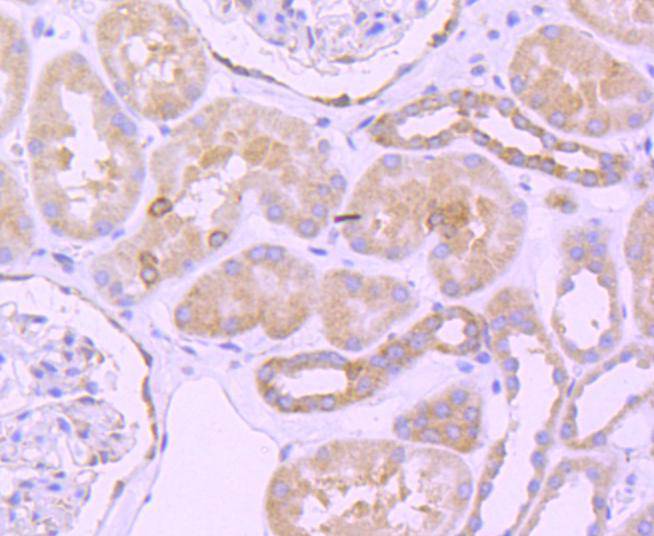 Immunohistochemical analysis of paraffin-embedded human kidney tissue using anti-Bcl-2 antibody. Counter stained with hematoxylin.