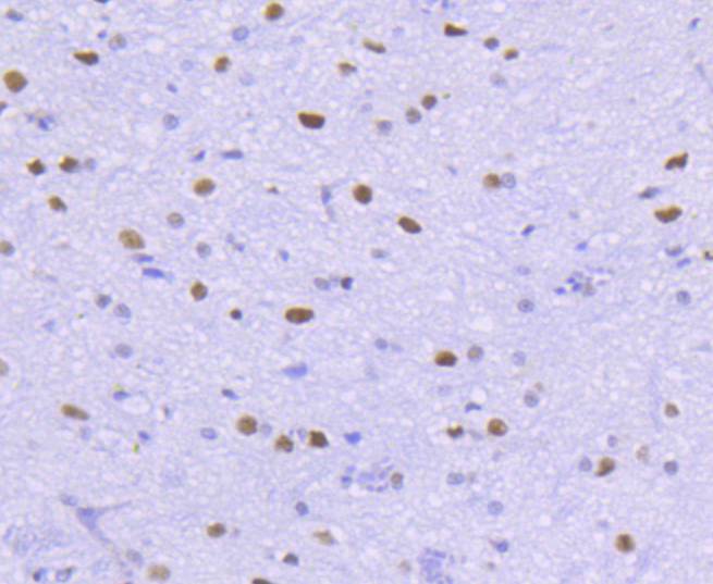 Immunohistochemical analysis of paraffin-embedded rat spinal cord tissue using anti-HDAC2 antibody. Counter stained with hematoxylin.