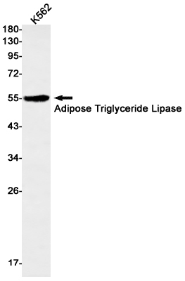 Western blot detection of Adipose Triglyceride Lipase in K562 cell lysates using Adipose Triglyceride Lipase Rabbit mAb(1:500 diluted).Predicted band size:55kDa.Observed band size:55kDa.