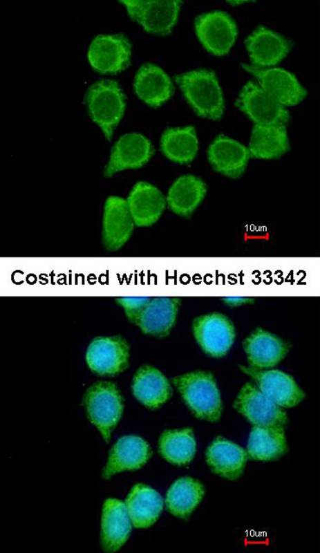 TNFRSF19L antibody