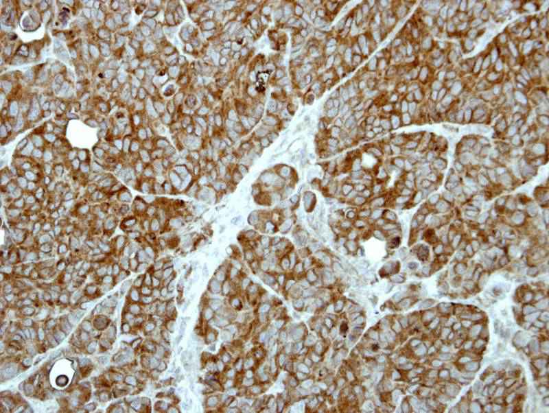 MP1 antibody