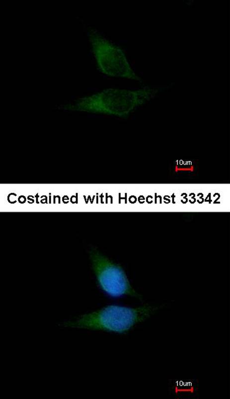 ORP-1 antibody