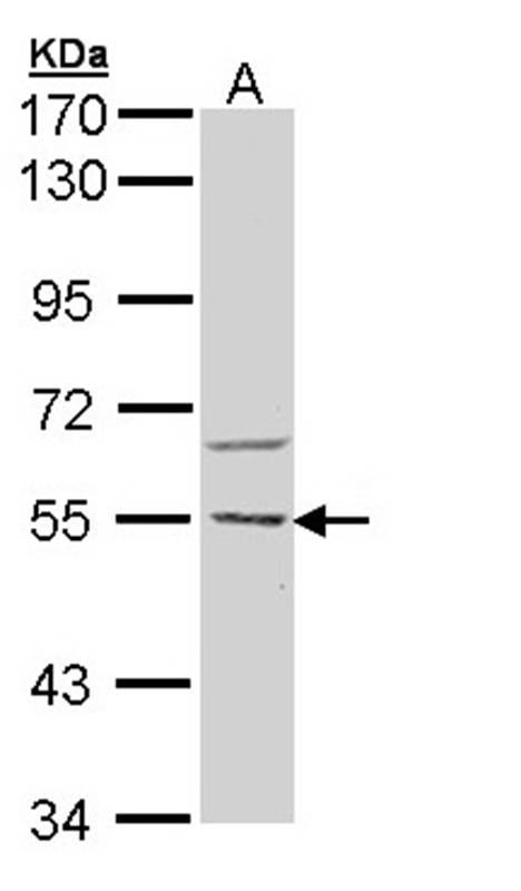 CaMKK beta antibody