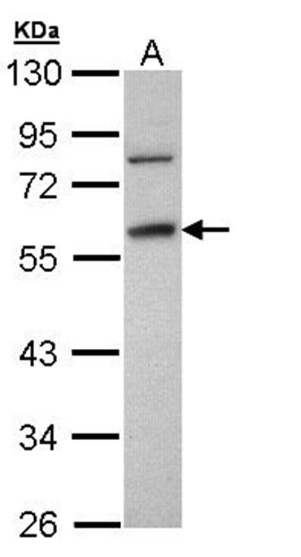 Fibrinogen gamma antibody