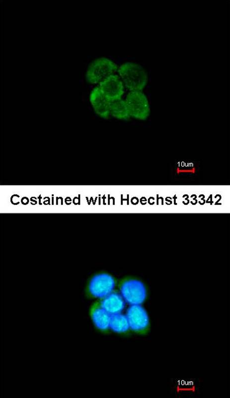 alpha-2 antiplasmin antibody