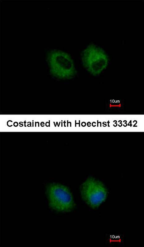 IL1R2 antibody