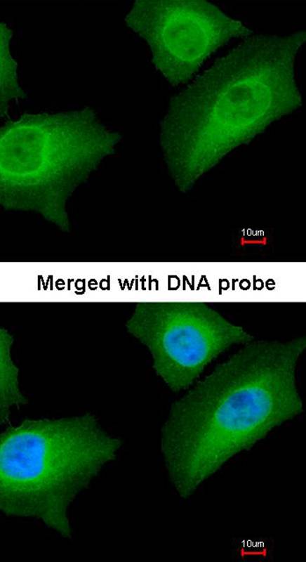 Annexin A1 antibody