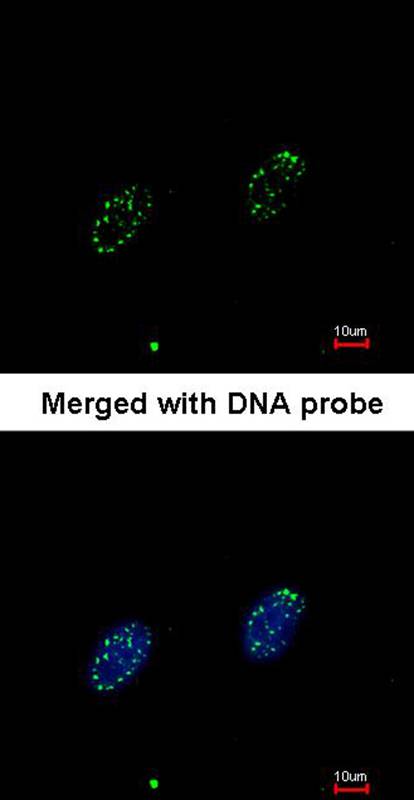 RPA 70 kDa subunit antibody