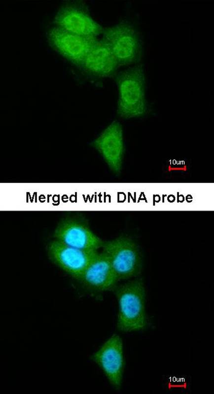 PSMB8 antibody