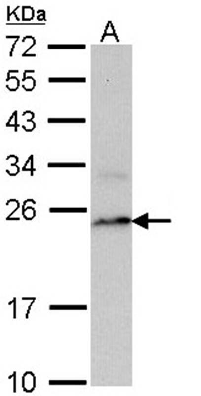 PSMB8 antibody