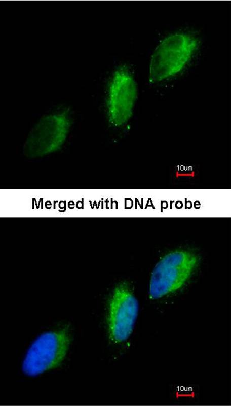 TYK2 antibody