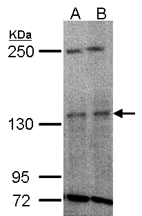 TYK2 antibody