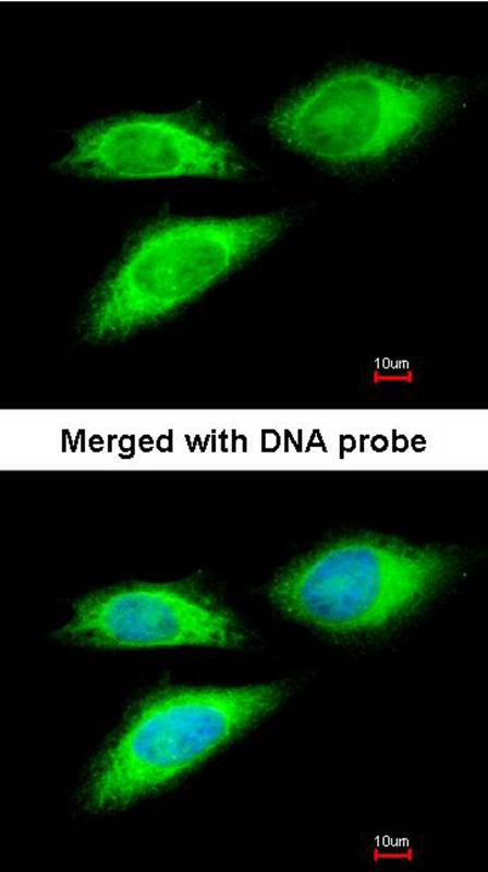 BAG5 antibody