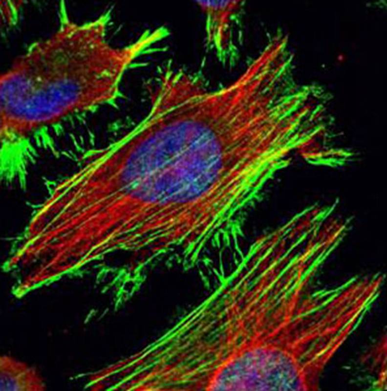 Beta Actin antibody