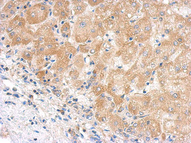 C5 antibody