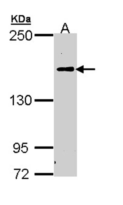 C5 antibody