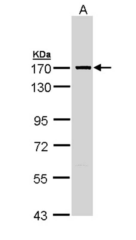 SMC1A antibody