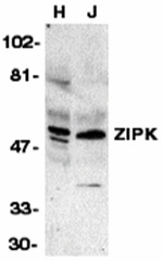 ZIPK Antibody