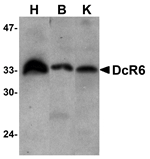 DcR3 Antibody