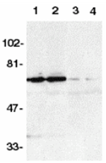 DR6 Antibody