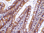 CIDE-B Antibody