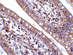 CIDE-B Antibody