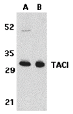 TACI Antibody