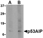 p53AIP1 Antibody