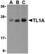 TL1A Antibody