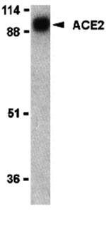 ACE2 Antibody