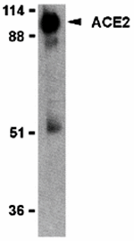 ACE2 Antibody