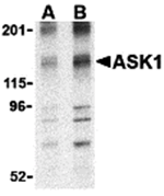 ASK1 Antibody