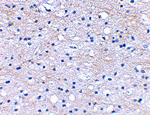 BRAL1 Antibody