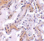 CAPN6 Antibody