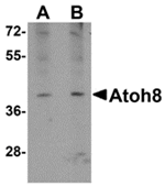 ATOH8 Antibody