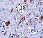 ATOH8 Antibody