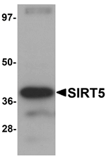 SIRT5 Antibody