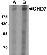 CHD7 Antibody