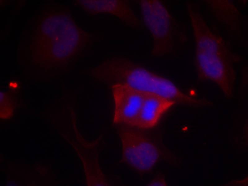 DARPP-32(Phospho-Thr75) Antibody