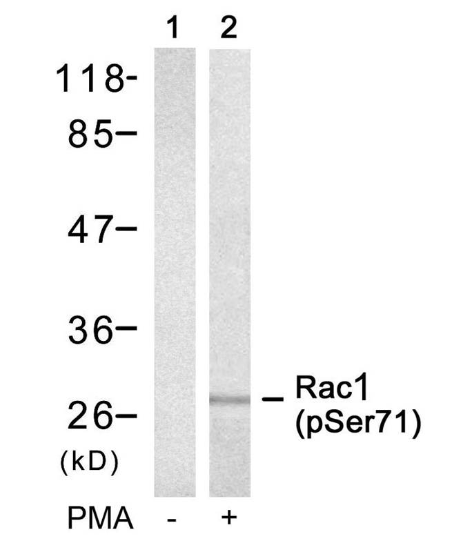 Rac1(Phospho-Ser71) Antibody