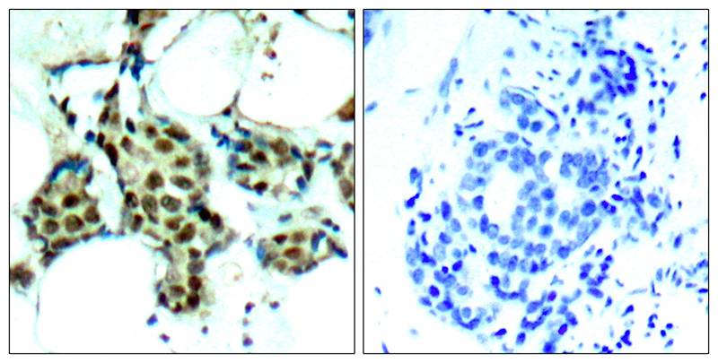 P38 MAPK(Phospho-Tyr182) Antibody