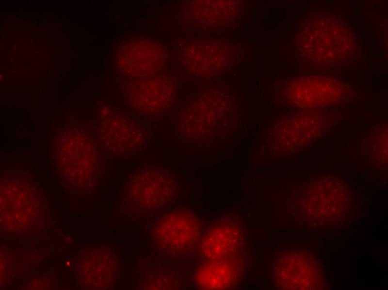 p70 S6 Kinase(Phospho-Thr421) Antibody