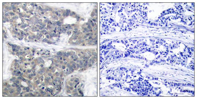 p70 S6 Kinase(Phospho-Thr421) Antibody