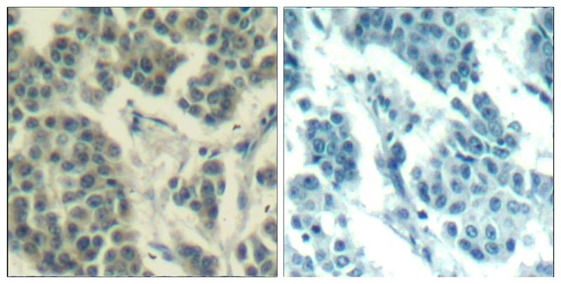 Her3/ErbB3(phospho-Tyr1328) Antibody