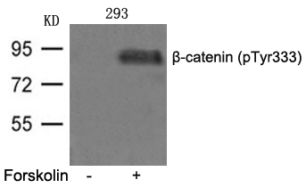 β-catenin(phospho-Tyr333) Antibody