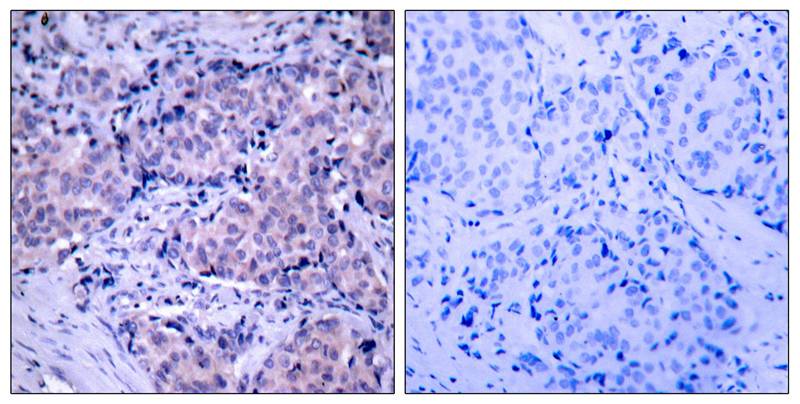 PDK1(Ab-241) Antibody