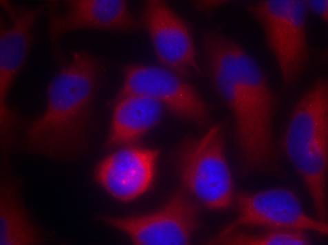 PAK1(Ab-212) Antibody