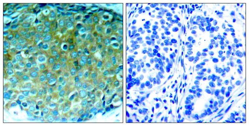 PAK1(Ab-212) Antibody