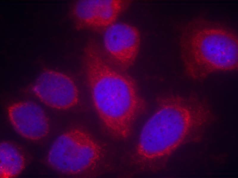 CPI17a(Ab-38) Antibody