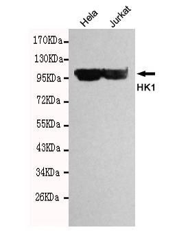 HK1 Monoclonal Antibody